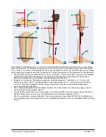 Preview for 11 page of Otto Bock 3C86-1 Instructions For Use Manual