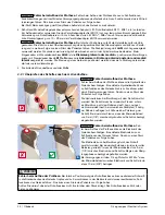 Preview for 12 page of Otto Bock 3C86-1 Instructions For Use Manual