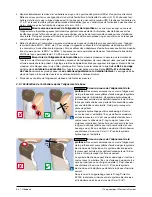 Preview for 54 page of Otto Bock 3C86-1 Instructions For Use Manual