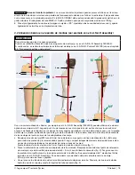 Preview for 75 page of Otto Bock 3C86-1 Instructions For Use Manual