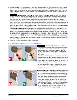 Preview for 76 page of Otto Bock 3C86-1 Instructions For Use Manual