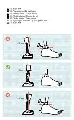 Preview for 9 page of Otto Bock 3R78 Operator'S Quick Reference Manual