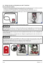 Предварительный просмотр 11 страницы Otto Bock 7E10 Helix 3D Instructions For Use Manual