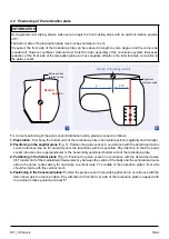 Предварительный просмотр 32 страницы Otto Bock 7E10 Helix 3D Instructions For Use Manual