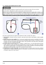 Предварительный просмотр 77 страницы Otto Bock 7E10 Helix 3D Instructions For Use Manual