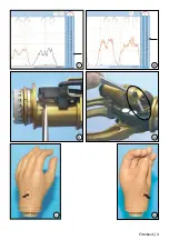 Preview for 3 page of Otto Bock 8E38-7 Instructions For Use Manual