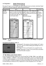 Предварительный просмотр 17 страницы Otto Bock 8E38 9 Instructions For Use Manual