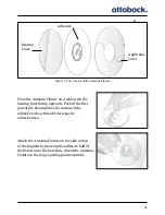 Preview for 32 page of Otto Bock ActiGait User Manual