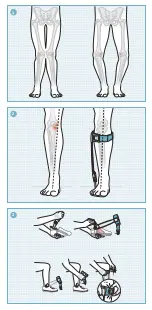 Preview for 3 page of Otto Bock Agilium Freestep 3.0 Information For Users