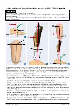 Предварительный просмотр 11 страницы Otto Bock C-Leg Prosthetic System Instructions For Use Manual