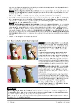 Предварительный просмотр 12 страницы Otto Bock C-Leg Prosthetic System Instructions For Use Manual