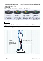 Предварительный просмотр 14 страницы Otto Bock C-Leg Prosthetic System Instructions For Use Manual