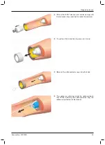 Preview for 13 page of Otto Bock DynamicArm 12K100N Instructions For Use Manual