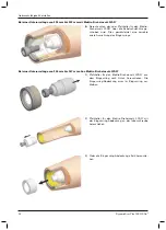 Предварительный просмотр 12 страницы Otto Bock DynamicArm Plus Instructions For Use Manual