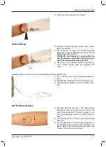 Предварительный просмотр 17 страницы Otto Bock DynamicArm Plus Instructions For Use Manual