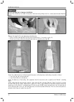 Предварительный просмотр 12 страницы Otto Bock E-MAG Active 17B203 Instructions For Use Manual