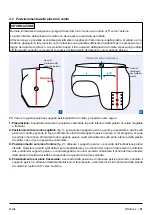 Предварительный просмотр 81 страницы Otto Bock Helix3D 7E10 Instructions For Use Manual