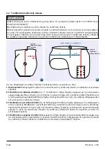 Предварительный просмотр 315 страницы Otto Bock Helix3D 7E10 Instructions For Use Manual