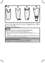 Preview for 6 page of Otto Bock Ipso Cast 743G15 Instructions For Use Manual