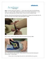 Preview for 2 page of Otto Bock Wrist Disarticulation Myoelectric Hand Assembling Procedure