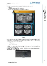 Preview for 88 page of Owandy Radiology i-max touch 3D User Manual