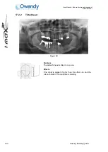 Preview for 113 page of Owandy Radiology i-max touch 3D User Manual