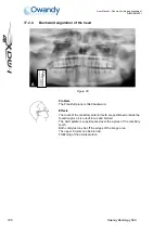 Preview for 115 page of Owandy Radiology i-max touch 3D User Manual