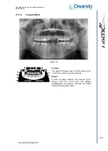 Preview for 116 page of Owandy Radiology i-max touch 3D User Manual