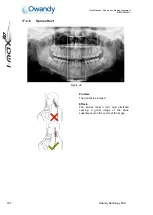 Preview for 117 page of Owandy Radiology i-max touch 3D User Manual