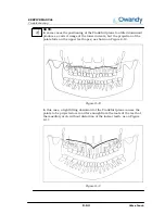 Предварительный просмотр 169 страницы Owandy Radiology i-max touch Service Manual