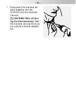 Preview for 39 page of Pari VORTEX Tracheo Instructions For Use Manual