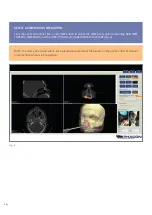 Preview for 14 page of PHACON SINUS TRAINER User Manual