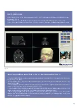 Preview for 15 page of PHACON SINUS TRAINER User Manual