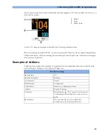 Preview for 107 page of Philips Avalon FM20 Instructions For Use Manual