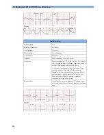 Preview for 108 page of Philips Avalon FM20 Instructions For Use Manual