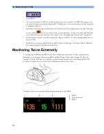 Preview for 114 page of Philips Avalon FM20 Instructions For Use Manual