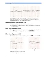 Preview for 118 page of Philips Avalon FM20 Instructions For Use Manual