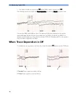 Preview for 124 page of Philips Avalon FM20 Instructions For Use Manual