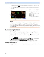 Preview for 140 page of Philips Avalon FM20 Instructions For Use Manual