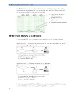 Preview for 156 page of Philips Avalon FM20 Instructions For Use Manual