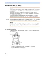 Preview for 158 page of Philips Avalon FM20 Instructions For Use Manual