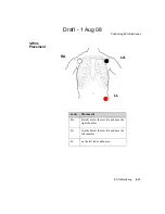 Предварительный просмотр 107 страницы Philips IntelliVue TRx Instructions For Use Manual