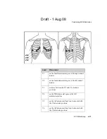 Предварительный просмотр 113 страницы Philips IntelliVue TRx Instructions For Use Manual