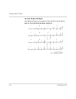 Preview for 36 page of Philips M1772A Instructions For Use Manual