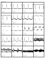 Preview for 126 page of Philips PTV800 Service Manual