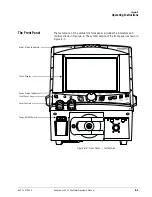 Preview for 81 page of Philips Respironics V200 Operator'S Manual