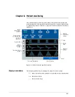 Preview for 111 page of Philips Respironics V60 User Manual