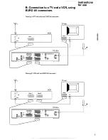 Preview for 13 page of Philips STU 904 Instructions For Use Manual