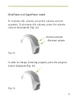 Preview for 17 page of Phonak Naida S CRT III SP User Manual