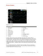 Preview for 35 page of Physio Control LIFEPAK 15 Operating Instructions Manual